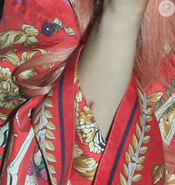 Lady Gaga exibiu um corte no braço direito, logo abaixo da manga da blusa