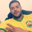 Hulk faz fisioterapia em Fortaleza e exame não constata lesão na coxa do atleta