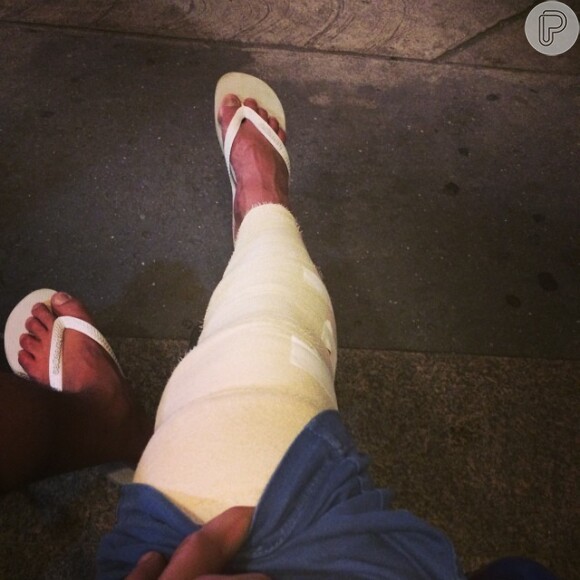 Bruno de Luca rompeu os ligamentos do joelho da perna direita