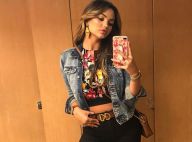 Mais colágeno e menos flacidez: Suzanna Freitas afina silhueta após tratamento