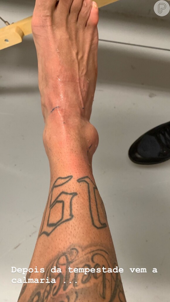 Neymar tornozelo lesionado após partida contra o Catar