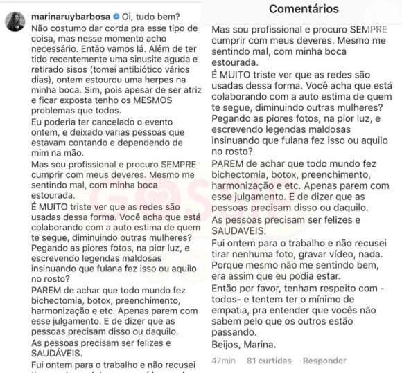 Marina Ruy Barbosa rebate crítica na web em comentário no rosto nesta quarta-feira, dia 28 de agosto de 2019