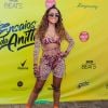 Anitta sobre hematomas nas pernas: 'Perrengue chique'