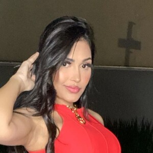 Ex-BBB Flayslane fez preenchimento labial