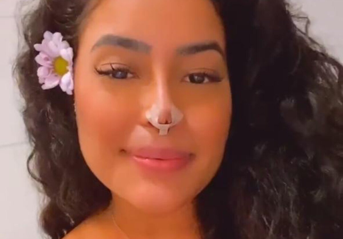 Foto: Influencer Sthefane Matos tem cartilagem do nariz exposta e passa por  cirurgia de emergência - Purepeople