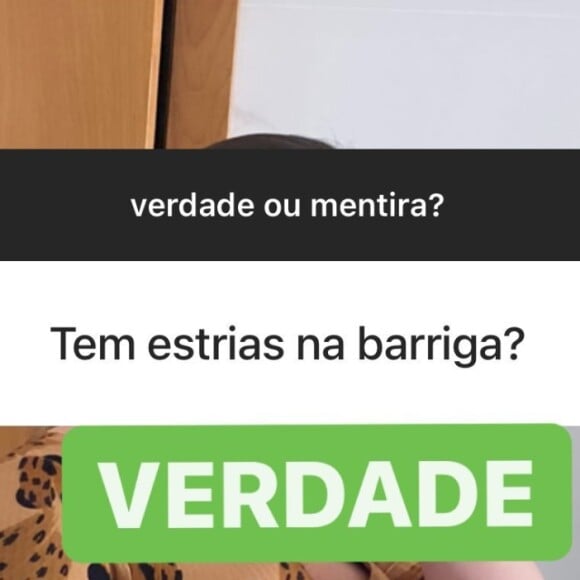 Marília Mendonça mostra estrias na barriga em foto