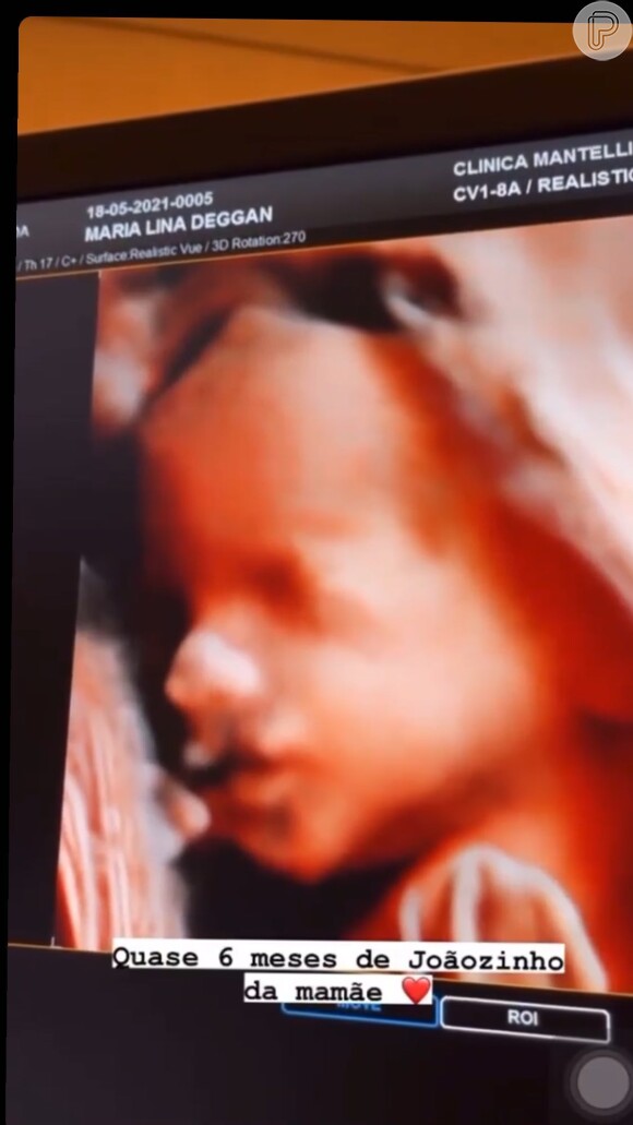 Maria Lina mostra rosto do filho com Whindersson Nunes em ultrassom: 'Quase 6 meses'