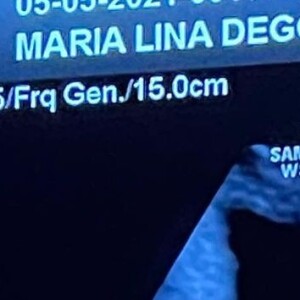 Filho de Maria Lina com Whindersson Nunes nasceu prematuro em maio