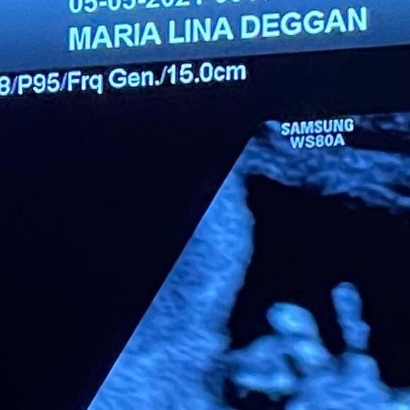 Filho de Maria Lina com Whindersson Nunes nasceu prematuro em maio