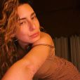   Fernanda Paes Leme revela ter síndrome do intestino irritável  