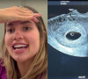 Virgínia Fonseca mostra foto de primeiro ultrassom após descobrir nova gravidez e emociona seguidores