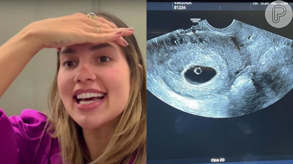 Virgínia Fonseca mostra foto de primeiro ultrassom após descobrir nova gravidez e emociona seguidores
