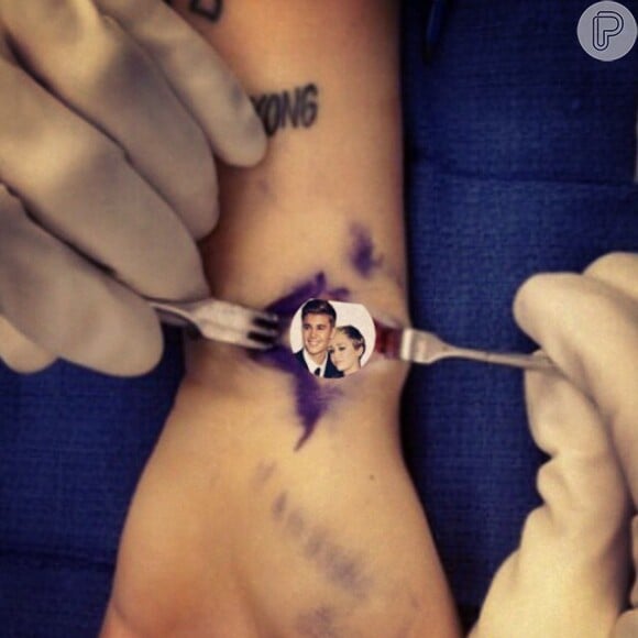 Miley Cyrus brinca com machucado e coloca foto dela ao lado de Justin Bieber em ferida aberta: 'Bieber veinz'