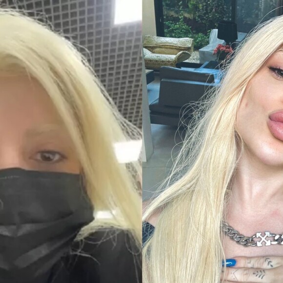 Gkay reage a vídeo com seu antes e depois e preocupa fãs