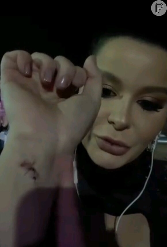 Maraisa exibiu o ferimento no pulso em um vídeo para tranquilizar os fãs