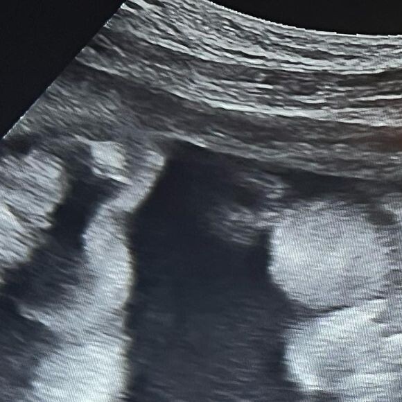 Segunda filha de Virgínia Fonseca se chamará Maria Flor