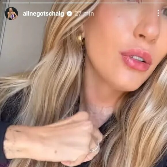 Para os seguidores, Aline Gotschalg mostou cicatriz da cirurgia
