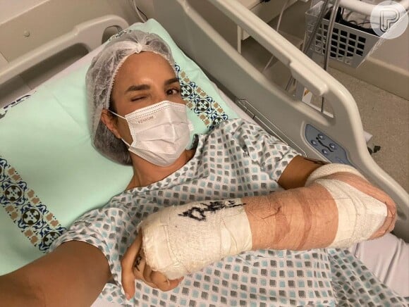 Ivete Sangalo realizou uma operação no braço