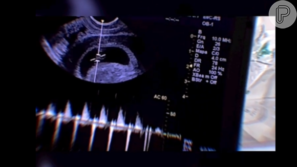 Gravidez de Viih Tube: a futura mamãe mostrou detalhes do ultrassom