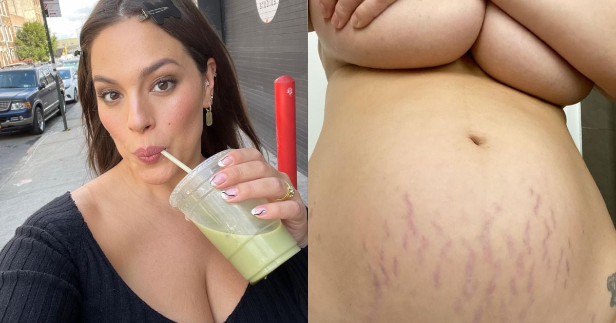 A modelo Ashley Graham exibiu a barriga antes mesmo do nascimento do  primeiro filho e não se intimidou em mostrar as estrias avermelhadas -  Purepeople