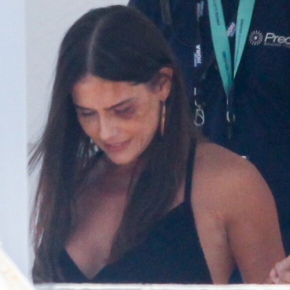 Deborah Secco é flagrada com machucados