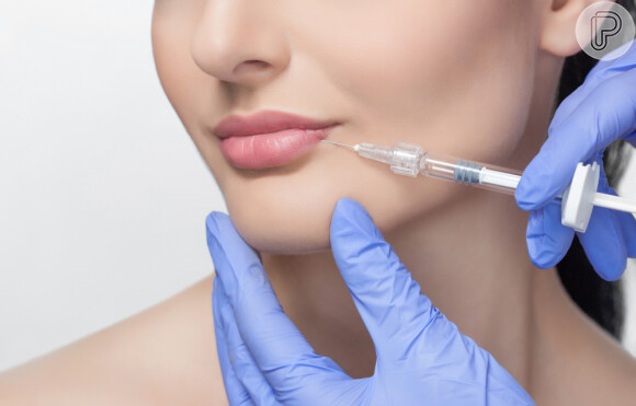 Preenchimento labial: técnica consiste na aplicação de substâncias que preenchem o interior dos lábios com o uso de uma microcânula ou agulha