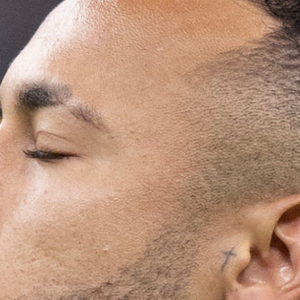 Apesar do machucado de Neymar, Brasil ganhou o primeiro jogo da Copa do Mundo 2022