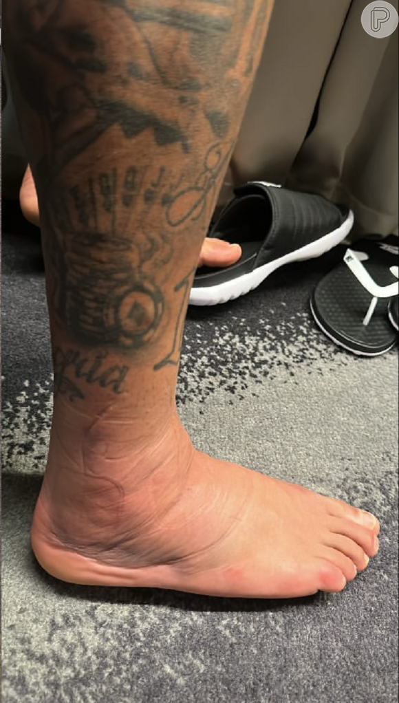 Tornozelo de Neymar ficou inchado devido à lesão