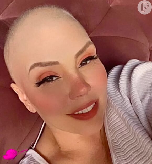 Careca, Simony mostra cabeça raspada após fim de tratamento contra o câncer