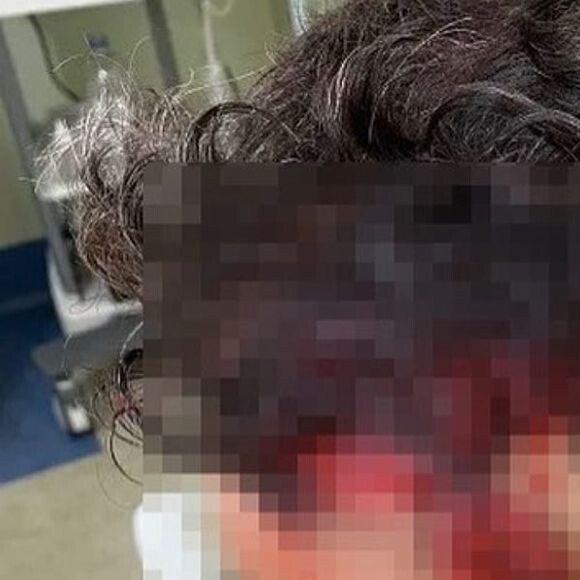 Thiago Rodrigues foi encontrado desacordado com múltiplos ferimentos na cabeça em uma praça do Rio de Janeiro