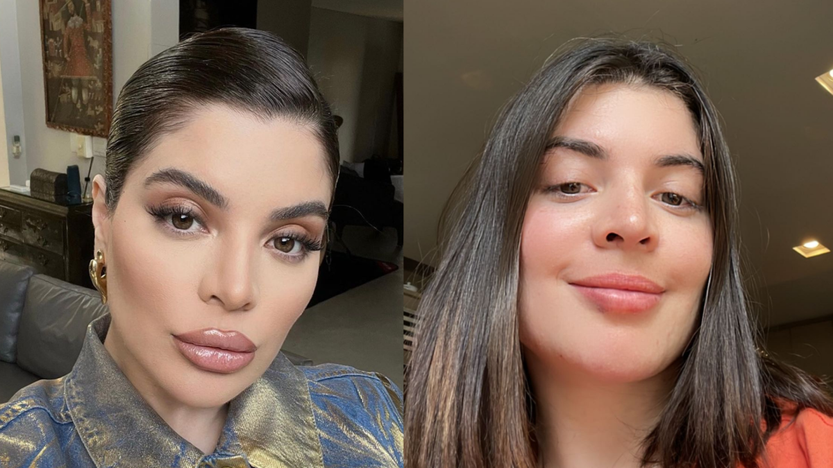 Foto Gkay Sem Preenchimento Labial Veja O Antes E Depois Purepeople