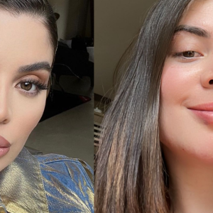 Gkay sem preenchimento labial: veja o antes e depois