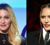 O antes e depois de Madonna impressiona