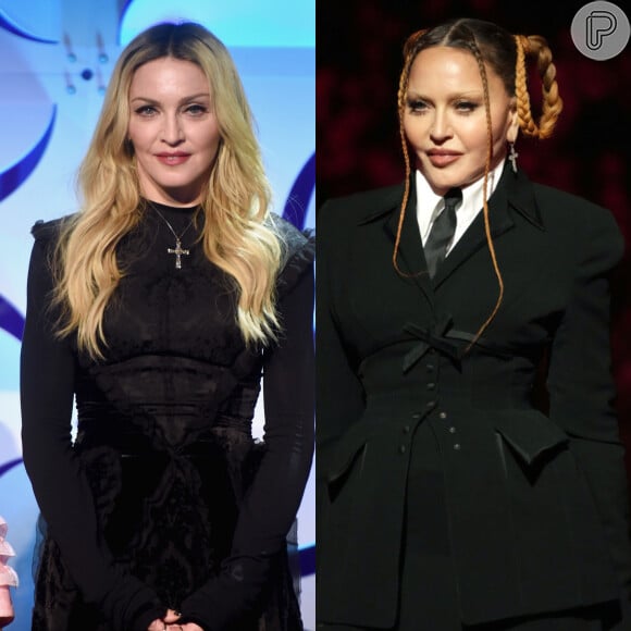 O antes e depois de Madonna impressiona