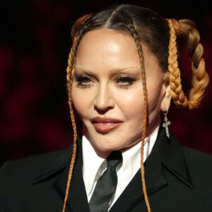 As mudanças no rosto de Madonna impressionaram os fãs da cantora