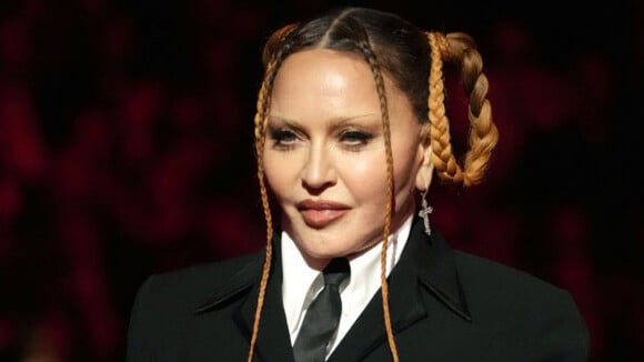 O que aconteceu com o rosto de Madonna? Especialista explica mudança no visual da cantora