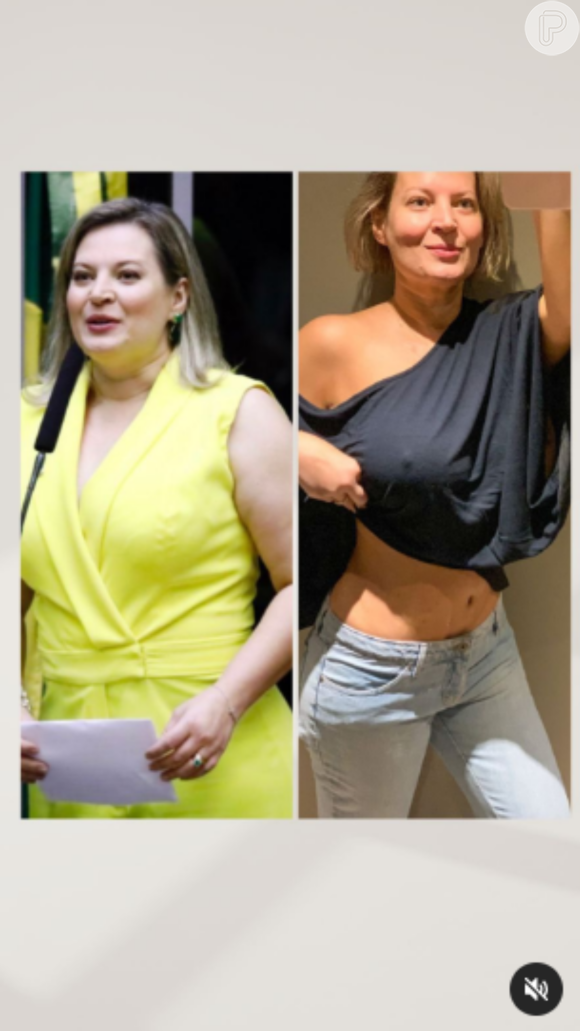 Foto O Antes E Depois De Joice Hasselmann Purepeople