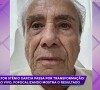 Stenio Garcia passou por uma harmonização facial em uma pauta do programa 'Fofocalizando', do SBT