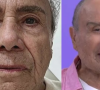 Stenio Garcia faz harmonização facial: veja antes e depois