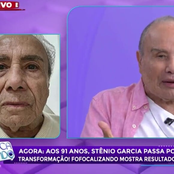 Harmonização facial de Stenio Garcia: ator passou por mudanças na mandíbula, no malar, na boca e até na sobrancelha