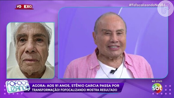 Stenio Garcia foi alvo de comparações irônicas após harmonização facial: 'Parece o ex da Jojo Todynho'