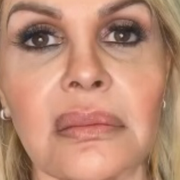 Harmonização facial de Monique Evans causou reação positiva da web