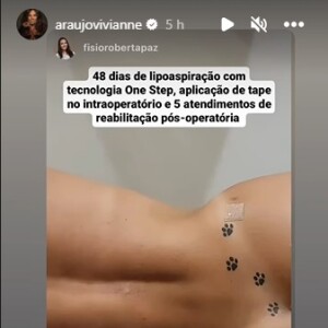 Viviane Araujo deixou tatuagem íntima à mostra ao exibir resultado de lipoaspiração