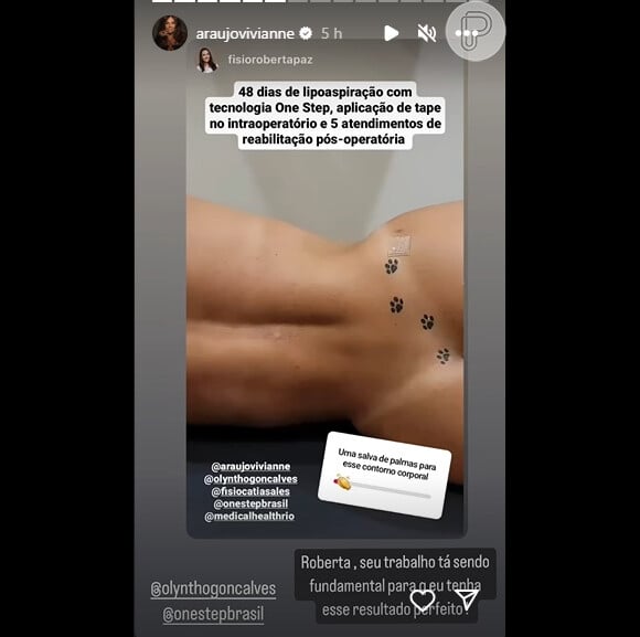Viviane Araujo deixou tatuagem íntima à mostra ao exibir resultado de lipoaspiração