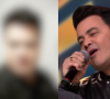 Sertanejo Renner faz harmonização facial na mesma clínica de Stenio Garcia e resultado impressiona