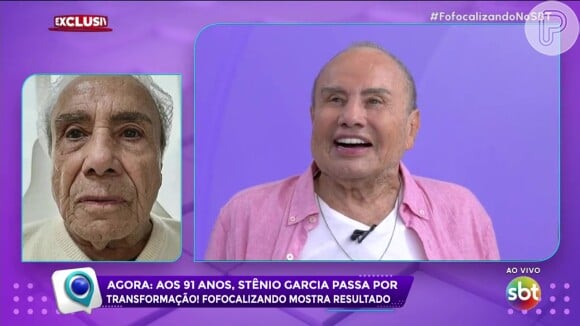 Stenio Garcia fez harmonização facial na mesma clínica de Renner