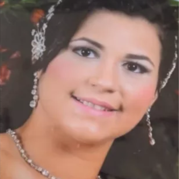 Deolane Bezerra antes das plásticas 