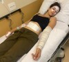 Filha de Silvio Brito, Clarissa Brito apareceu no hospital tomando medicação e com braço enfaixado após sofrer queimaduras