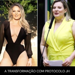 Joice Hasselmann publicou um carrossel de fotos onde compara seu antes e depois