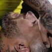 Neymar perde jogo do Al-Hilal por conta de lesão no joelho e posta foto bizarra do machucado: 'Não é de Deus'